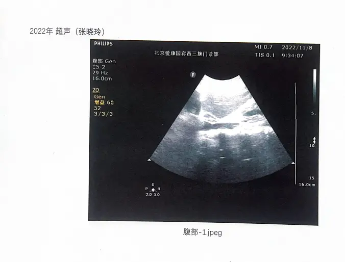 患癌女律师收到北京卫健委答复：未发现体检结果造假，爱康一门诊部违规被罚2000元